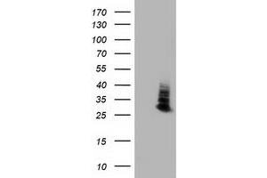 HEK293T cells were transfected with the pCMV6-ENTRY control (Left lane) or pCMV6-ENTRY AQP1 (Right lane) cDNA for 48 hrs and lysed. (Aquaporin 1 抗体)