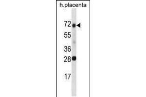 Western Blotting (WB) image for anti-serine Peptidase Inhibitor, Kunitz Type 1 (SPINT1) (AA 178-207) antibody (ABIN5536233)