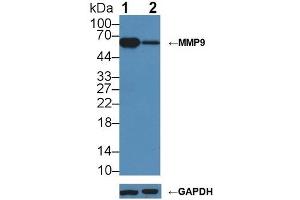 Western Blotting (WB) image for anti-Matrix Metallopeptidase 9 (Gelatinase B, 92kDa Gelatinase, 92kDa Type IV Collagenase) (MMP9) (AA 225-390) antibody (ABIN7432016)