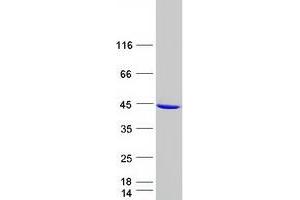 Western Blotting (WB) image for Galactose Mutarotase (Aldose 1-Epimerase) (GALM) protein (Myc-DYKDDDDK Tag) (ABIN2714563)