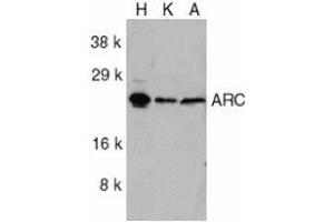 Western blot analysis of ARC in HeLa (H), KB (K), and A549 (A) whole cell lysates with AP30076PU-N ARC antibody at 1/1000 dilution. (NOL3 抗体  (C-Term))