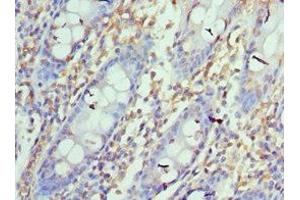 Immunohistochemistry of paraffin-embedded human colon tissue using ABIN7164673at dilution of 1:100 (PD-L1 抗体  (AA 19-238))