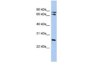 WB Suggested Anti-OVOL2 Antibody Titration: 0. (OVOL2 抗体  (Middle Region))