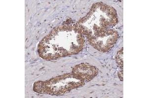Immunohistochemical staining of human prostate with CCDC9 polyclonal antibody  shows moderate cytoplasmic positivity in glandular cells. (CCDC9 抗体)