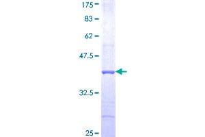 GRIK3 Protein (AA 151-250) (GST tag)