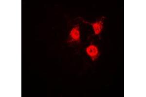 Immunofluorescent analysis of CDK2 staining in Jurkat cells. (CDK2 抗体  (C-Term))
