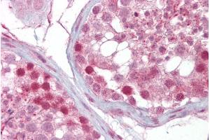 Immunohistochemistry with Testis tissue at an antibody concentration of 5µg/ml using anti-IFT88 antibody (ARP53658_P050) (IFT88 抗体  (Middle Region))