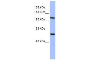 WB Suggested Anti-ZFPM1 Antibody Titration:  0. (ZFPM1 抗体  (Middle Region))