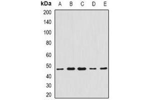 Western blot analysis of CCBL1 expression in Hela (A), A549 (B), mouse liver (C), mouse heart (D), rat kidney (E) whole cell lysates. (CCBL1 抗体)