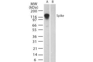 Image no. 1 for anti-SARS-Coronavirus Spike Protein (SARS-CoV S) (AA 19-35) antibody (ABIN199988) (SARS-CoV Spike 抗体  (AA 19-35))