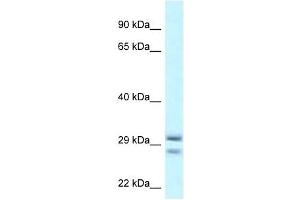 Western Blot showing RIT1 antibody used at a concentration of 1 ug/ml against THP-1 Cell Lysate (RIT1 抗体  (Middle Region))