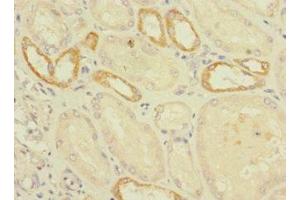 Immunohistochemistry of paraffin-embedded human kidney tissue using ABIN7175037 at dilution of 1:100 (C2ORF76 抗体  (AA 1-126))