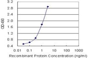 ACTN4 (Human) Matched Antibody Pair
