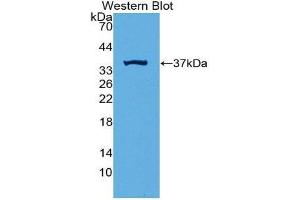 Western Blotting (WB) image for anti-Induced Myeloid Leukemia Cell Differentiation Protein Mcl-1 (MCL1) (AA 2-307) antibody (ABIN3205034) (MCL-1 抗体  (AA 2-307))