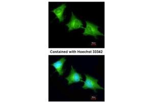 ICC/IF Image Immunofluorescence analysis of methanol-fixed HeLa, using SPR, antibody at 1:200 dilution. (SPR 抗体)