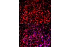Immunofluorescence analysis of A549 cells using TOMM20 antibody. (TOMM20 抗体  (AA 20-145))