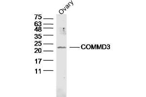 Mouse ovary lysates probed with COMMD3 Polyclonal Antibody, unconjugated  at 1:300 overnight at 4°C followed by a conjugated secondary antibody at 1:10000 for 90 minutes at 37°C. (COMMD3 抗体  (AA 101-195))