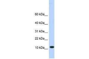 WB Suggested Anti-C10orf57 Antibody Titration:  0. (CJ057 抗体  (Middle Region))