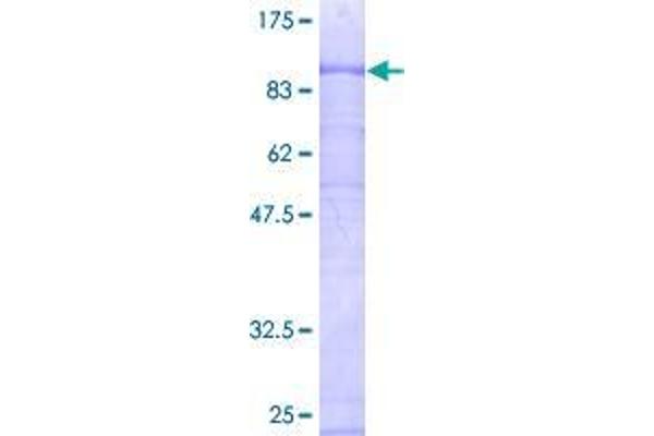 CIRH1A Protein (AA 1-686) (GST tag)