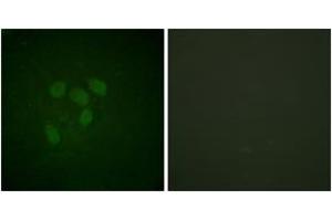 Immunofluorescence (IF) image for anti-Tumor Protein P53 (TP53) (AA 283-332), (acLys317) antibody (ABIN1535527)