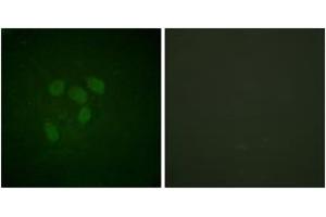 Immunofluorescence analysis of HeLa cells, using p53 (Acetyl-Lys317) Antibody. (p53 抗体  (acLys317))