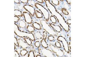 Immunohistochemistry of paraffin-embedded rat kidney using HGF Rabbit pAb (ABIN3021682, ABIN3021683, ABIN3021684 and ABIN6215504) at dilution of 1:100 (40x lens). (HGF 抗体  (AA 30-285))