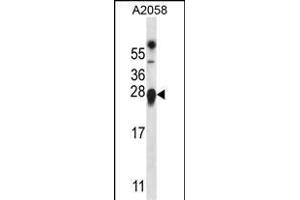 Western Blotting (WB) image for anti-Transmembrane Emp24 Protein Transport Domain Containing 9 (TMED9) (AA 169-198), (C-Term) antibody (ABIN657174)