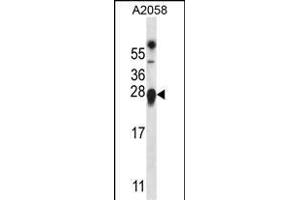 TMED9 Antibody (C-term) (ABIN657174 and ABIN2846305) western blot analysis in  cell line lysates (35 μg/lane). (TMED9 抗体  (C-Term))