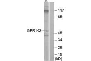 Western blot analysis of extracts from Jurkat cells, using GPR142 Antibody. (GPR142 抗体  (AA 1-50))