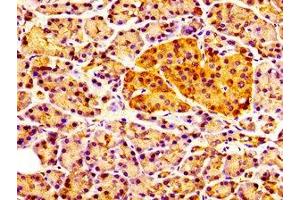 IHC image of ABIN7147596 diluted at 1:100 and staining in paraffin-embedded human pancreatic tissue performed on a Leica BondTM system. (CCKAR 抗体  (AA 235-313))