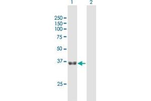 Western Blot analysis of GNPTG expression in transfected 293T cell line by GNPTG MaxPab polyclonal antibody. (GNPTG 抗体  (AA 1-305))