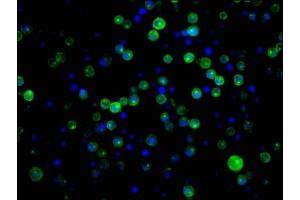 Immunofluorescence staining of Raji cells with ABIN7127277 at 1:34,counter-stained with DAPI. (Recombinant CD21 抗体)
