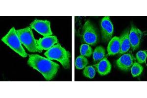 Confocal immunofluorescence analysis of methanol-fixed HepG2 (left) and Hela (right) cells using GAPDH mouse mAb (green), showing cytoplasmic localization. (GAPDH 抗体)