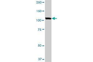 Western Blotting (WB) image for anti-USO1 Homolog, Vesicle Docking Protein (USO1) (AA 1-961) antibody (ABIN522073)