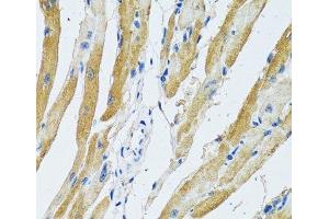 Immunohistochemistry of paraffin-embedded Rat heart using GDAP1 Polyclonal Antibody at dilution of 1:100 (40x lens).