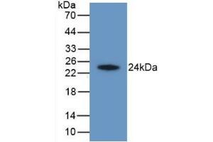 Detection of Recombinant HAVCR2, Human using Monoclonal Antibody to Hepatitis A Virus Cellular Receptor 2 (HAVCR2) (TIM3 抗体  (AA 22-202))