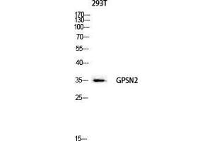 Western Blot (WB) analysis of 293T lysis using GPSN2 antibody. (TECR 抗体  (C-Term))