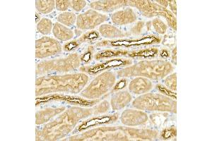 Immunohistochemistry (IHC) image for anti-Solute Carrier Family 12 (Potassium-Chloride Transporter) Member 2 (SLC12A2) (AA 120-280) antibody (ABIN6147843)