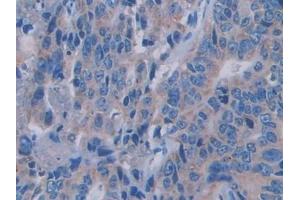 Immunohistochemistry (IHC) image for anti-Sema Domain, Immunoglobulin Domain (Ig), Short Basic Domain, Secreted, (Semaphorin) 3A (SEMA3A) (AA 580-664) antibody (ABIN7430102)