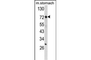 Western blot analysis of ZFP36 Antibody (Center) (ABIN652459 and ABIN2842311) in mouse stomach tissue lysates (35 μg/lane). (ZFP36 抗体  (AA 119-148))