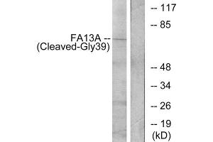 Western blot analysis of extracts from Jurkat cells, treated with etoposide (25uM, 24hours), using FA13A (Cleaved-Gly39) antibody. (FA13A (Cleaved-Gly39), (N-Term) 抗体)