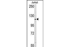 Western blot analysis of anti-USP11 Pab in Jurkat cell line lysates (35ug/lane). (USP11 抗体  (N-Term))