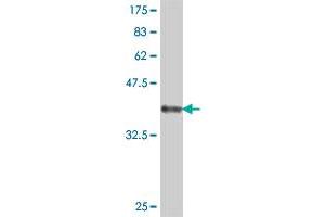 Western Blot detection against Immunogen (37. (PTH1R 抗体  (AA 27-134))