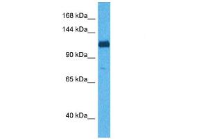Host:  Rabbit  Target Name:  ABI3BP  Sample Tissue:  Human 293T Whole Cell  Antibody Dilution:  1ug/ml (ABI3BP 抗体  (C-Term))