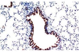 Immunohistochemistry of paraffin-embedded Mouse liver tissue using TGFB1 Monoclonal Antibody at dilution of 1:200. (TGFB1 抗体)
