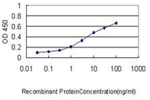 Detection limit for recombinant GST tagged GCLC is approximately 0. (GCLC 抗体  (AA 528-637))