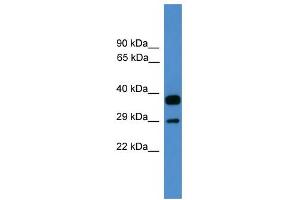 WB Suggested Anti-OTUB2 Antibody Titration: 0. (OTUB2 抗体  (Middle Region))