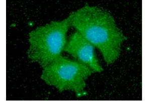 ICC/IF analysis of CPOX in Hep3B cells line, stained with DAPI (Blue) for nucleus staining and monoclonal anti-human CPOX antibody (1:100) with goat anti-mouse IgG-Alexa fluor 488 conjugate (Green). (CPOX 抗体)