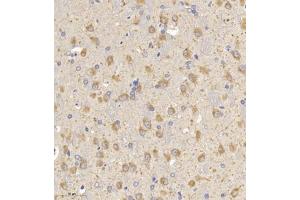 Immunohistochemistry of paraffin embedded rat brain using MAP9 (ABIN7074622) at dilution of 1:750 (300x lens) (MAP9 抗体)