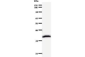 Western Blotting (WB) image for anti-Polymerase (DNA Directed), delta 2, Accessory Subunit (POLD2) (Regulatory Subunit 50) antibody (ABIN931066) (POLD2 抗体  (Regulatory Subunit 50))